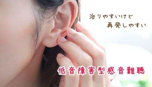 治りやすいけど再発しやすい！？低音障害型感音難聴の落とし穴