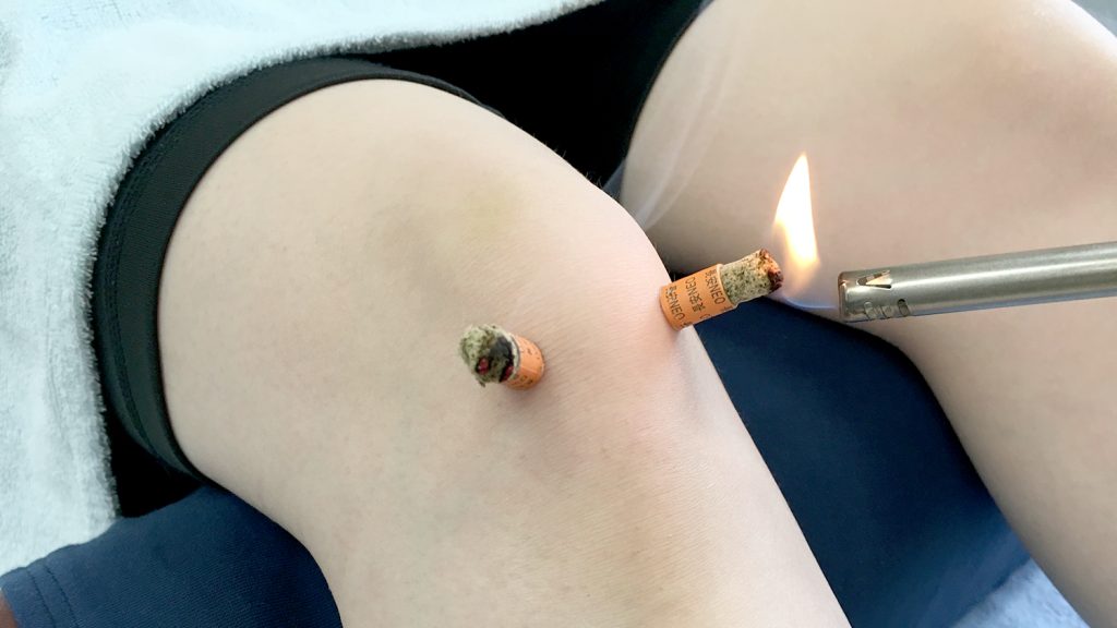 変形性膝関節症の治療