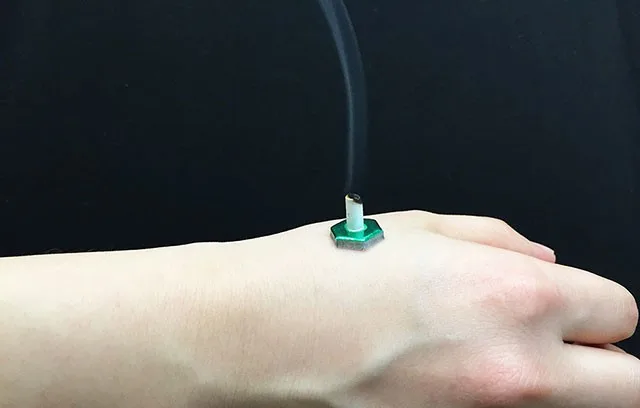 腱鞘炎の治療