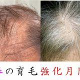 春から夏の育毛強化月間