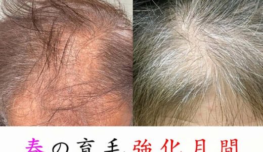 梅雨入り前の育毛強化月間