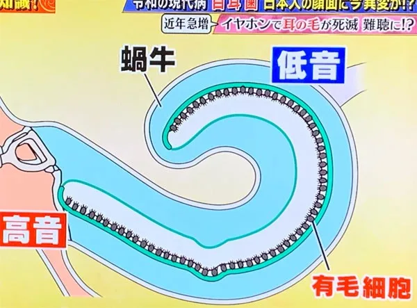 有毛細胞と難聴